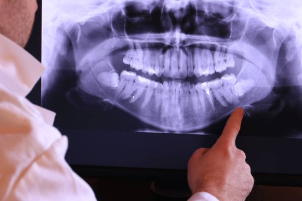Best Emergency Gum Treatment in Riverton, UT