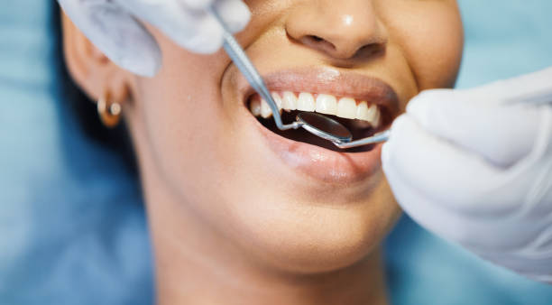 Best Emergency Treatment for Dental Infections or Abscesses in Riverton, UT